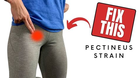 test for pectineus muscle tear|pectineus muscle pain.